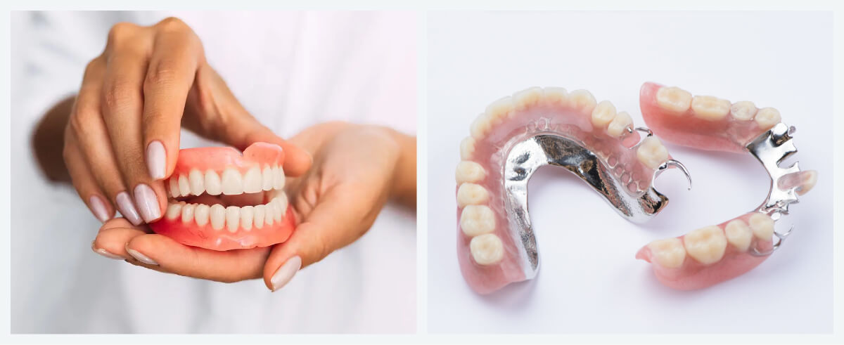 Dentures _ Partial Dentures